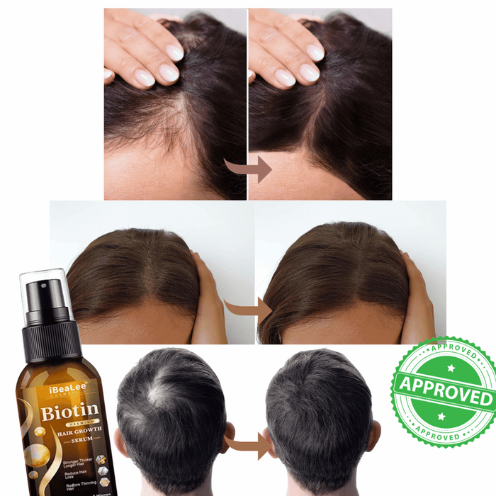 Spray Hair Growth Biotina